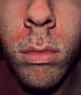 Почему шелушится кожа на щеках?
