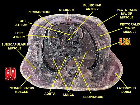 ไฟล์:Thorax section 4.jpg