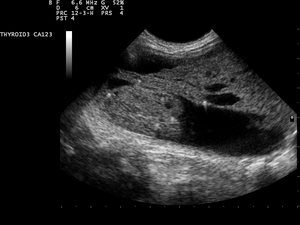 Ultrasound Scan ND 0124141638 1428320.png