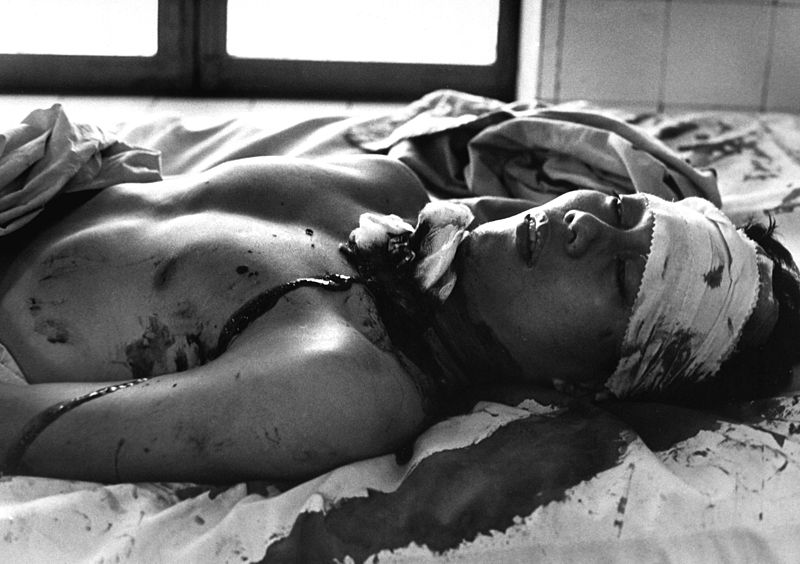 File:Vietcong bombing victim in Cong Hoa Hospital 1966-02.JPEG