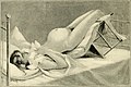 A textbook of obstetrics (1899) (14755273856).jpg