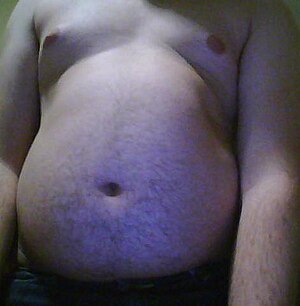 Belly of an obese teenage boy.jpg