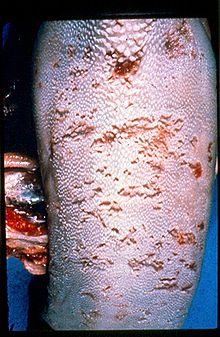 Tongue lesions on confirmed BVD/MD case (mucosal disease form) Bovine Virus Diarrhea tongue ulcers.jpg