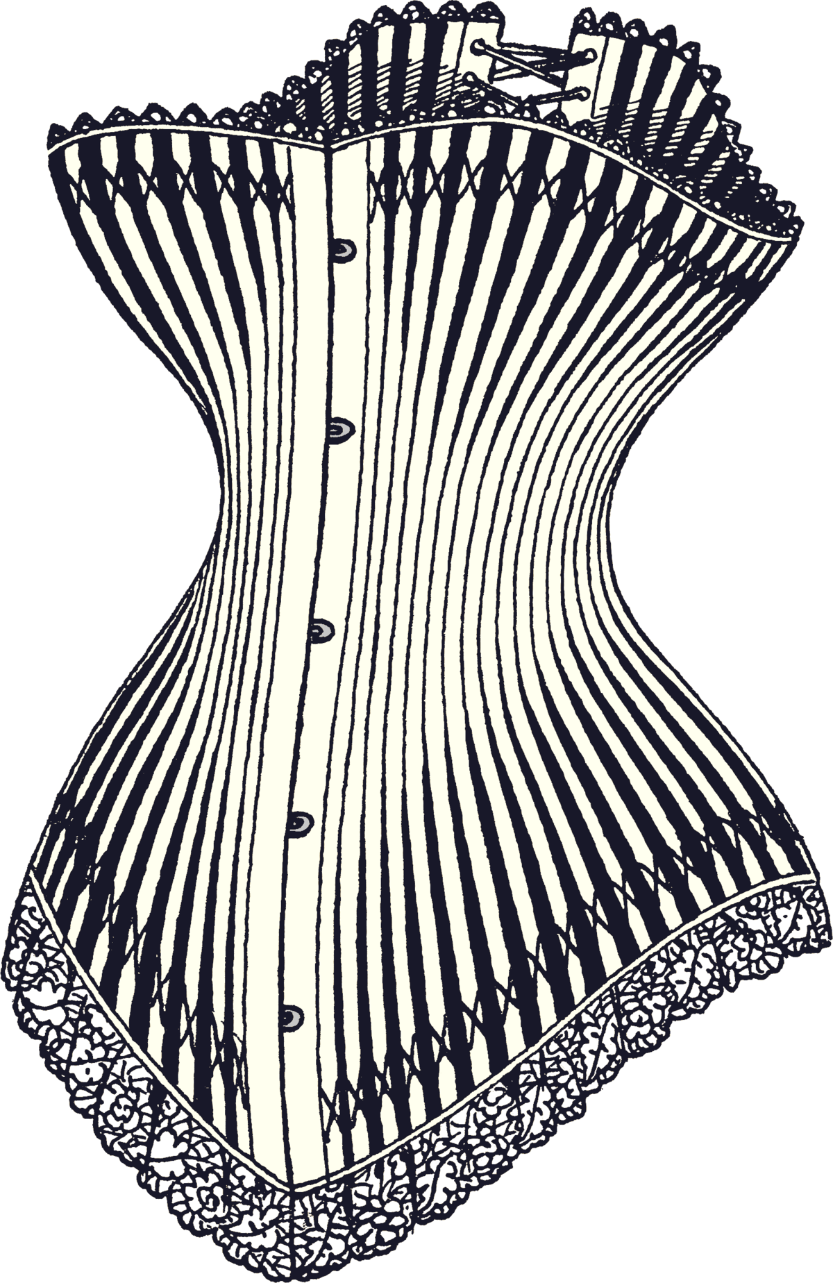 A pregnancy corset from 1900 is shown before the official start of