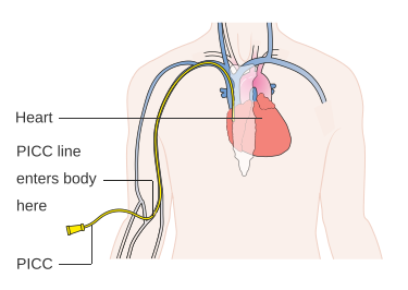 File:Diagram showing a PICC line CRUK 071.svg