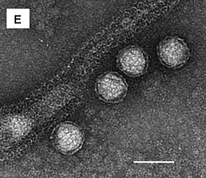 Sulfolobus polyhedral virus 3 (SPV3) alias Sulfolobus turreted icosahedral virus 3 (STIV3), TEM-Aufnahme