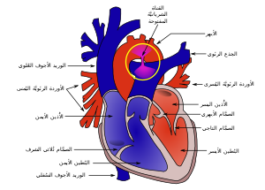 Heart Cross Section with Patent Ductus Ateriosus-ar.svg