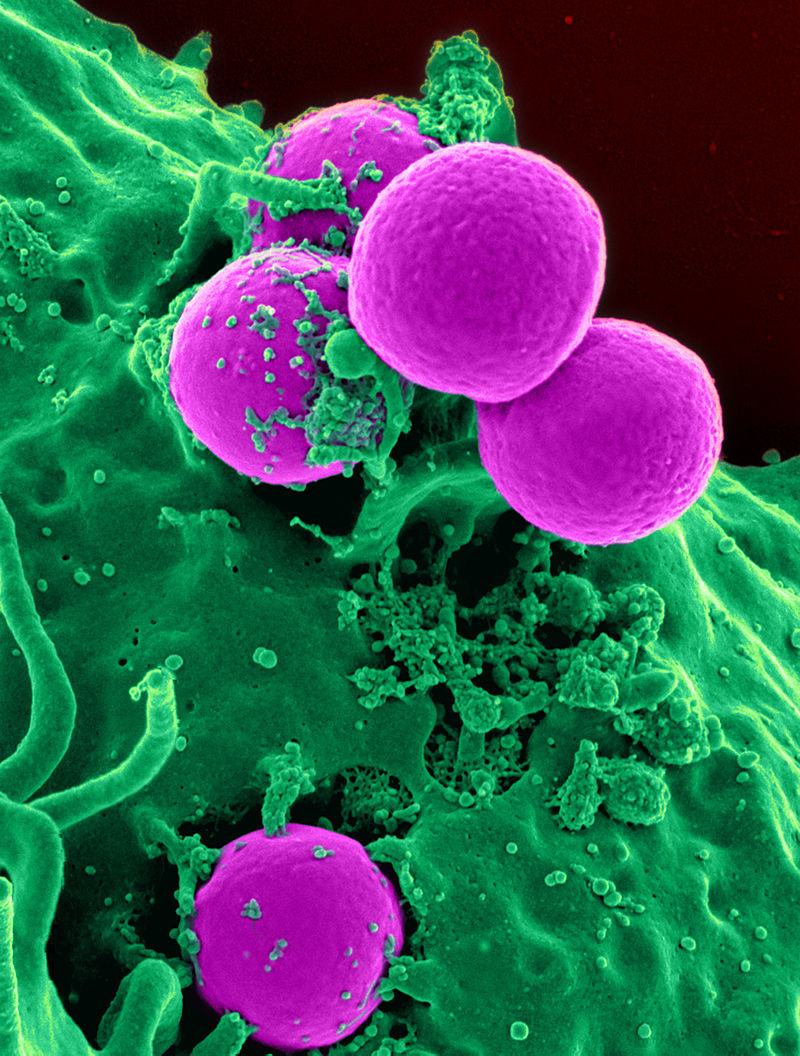 Distinguishing Deadly Staph Bacteria from Harmless Strains