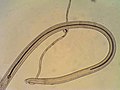 Posterior end of male Baruscapillaria anseris nematodes obtained from domestic goose.jpg