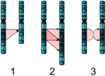 Vignette pour Anomalie chromosomique