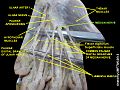 Median nerve