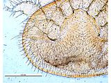 Varroa destructor female ventralNew Zealand, Auckland Mangere, 2 June 2000, ex Apis mellifera cobs from hive