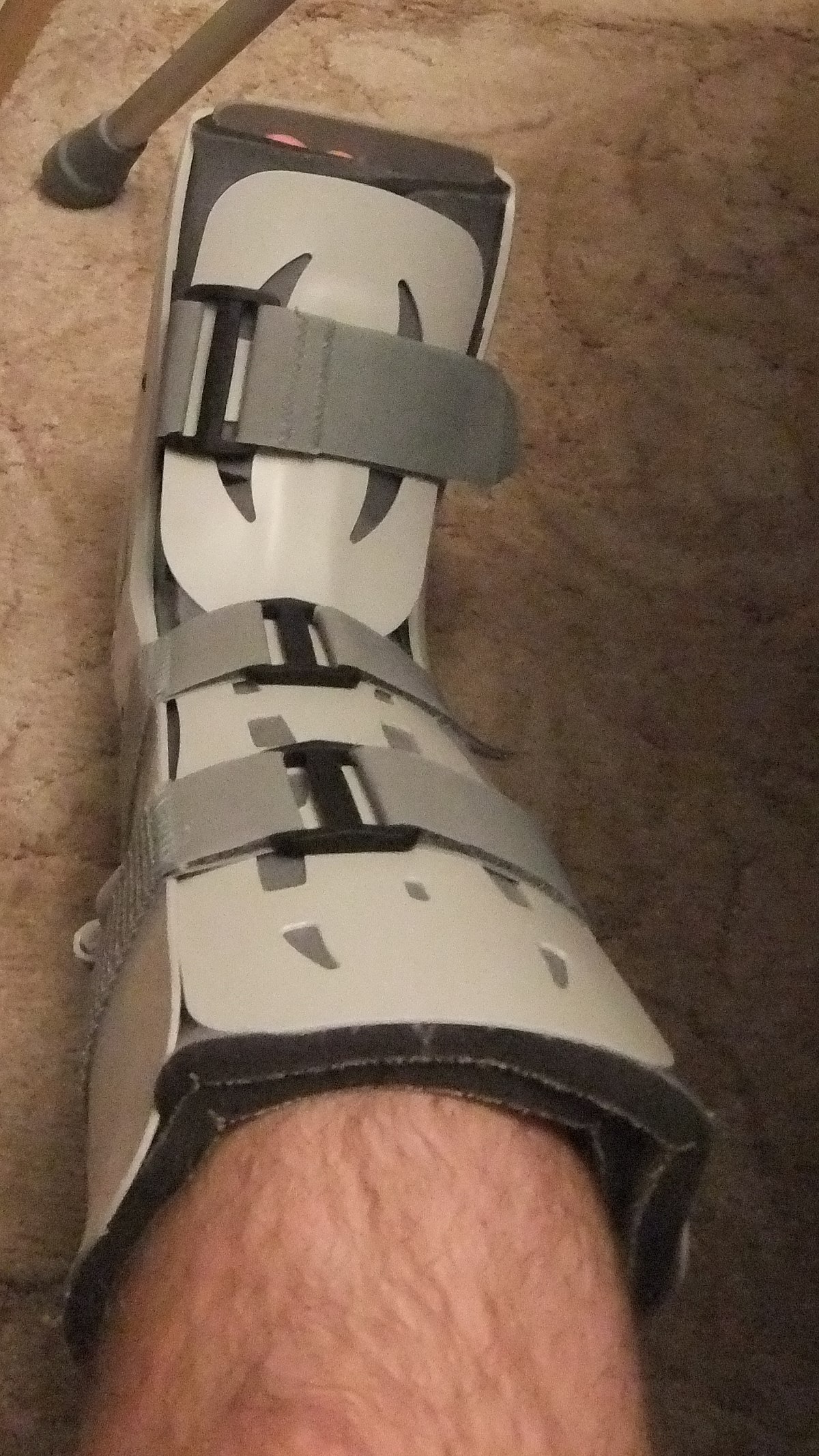 support boots for broken ankle