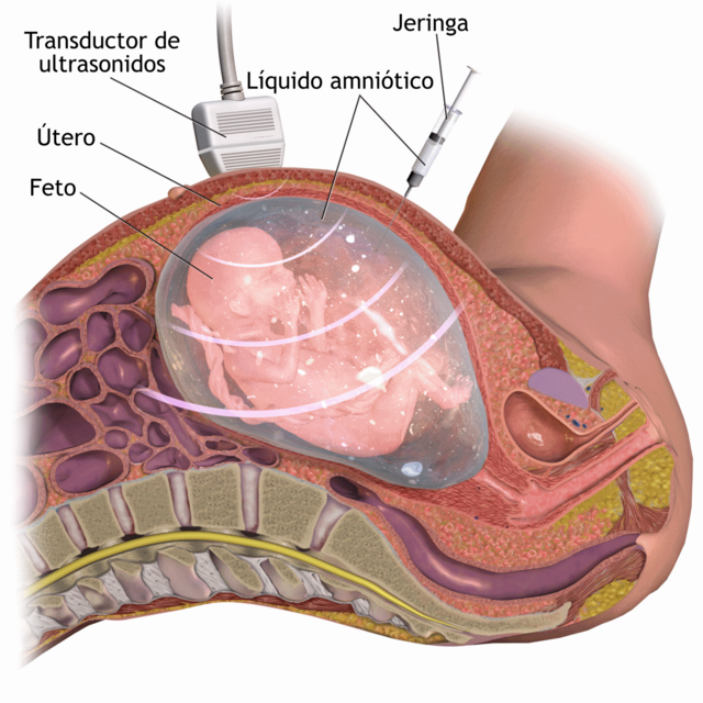 Medical wiki - Oftalmólogos ESPECIALISTAS en RETINA, allí donde