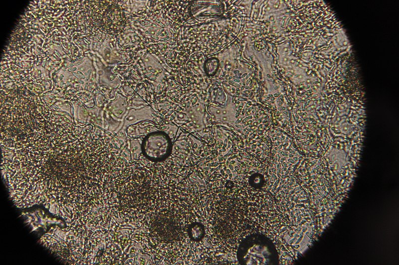 File:Anamorph on Lamium maculatum (41786684621).jpg