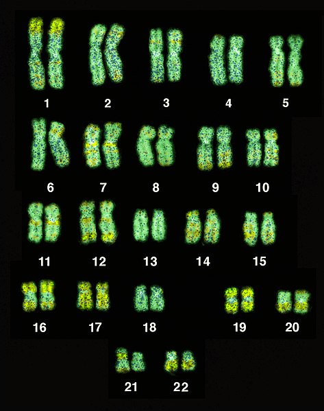 File:Chromosome set humans.jpg