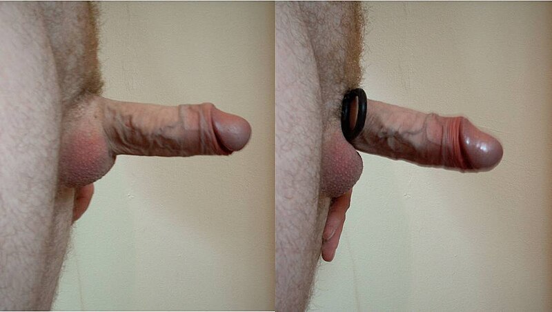 File:Cockringbeforeafter.jpg