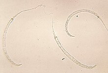 Dracunculus medinensis larvae.jpg
