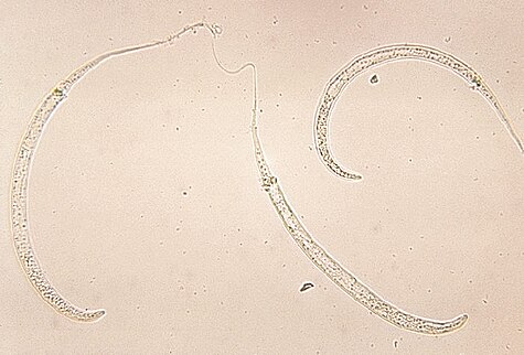 Dracunculus medinensis larvae.jpg