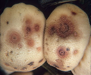 <i>Epicoccum nigrum</i> Species of fungus