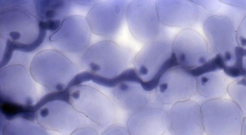 File:Hyaloperonospora-parasitica-hyphae-haustoria.jpg