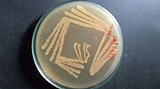 Thumbnail for Kytococcus sedentarius
