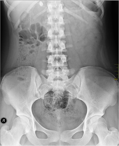 File:Medical X-Ray imaging VXQ07 nevit.jpg