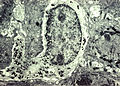 Melanocyte with melanin in dendrite to the left.jpg