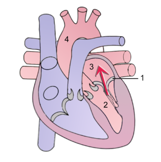 <span class="mw-page-title-main">Mitral regurgitation</span> Form of valvular heart disease