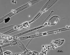 Czarno-białe zdjęcie mikroskopowe przedstawiające podłużne strzępki grzybni z elipsoidalnymi sporangioforami