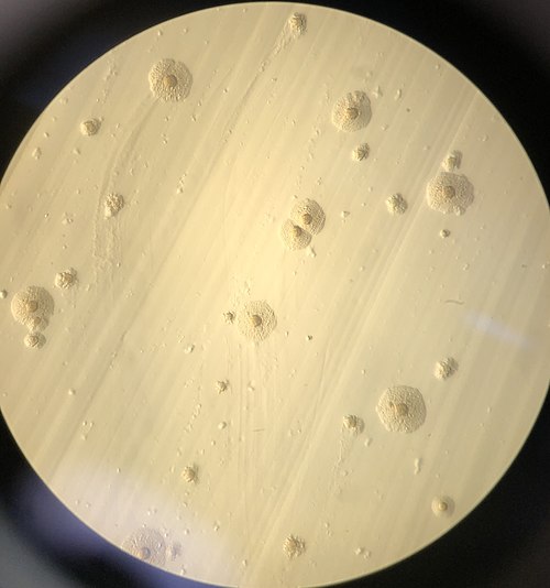 Colony morphology of Mycoplasma on Hayflick agar