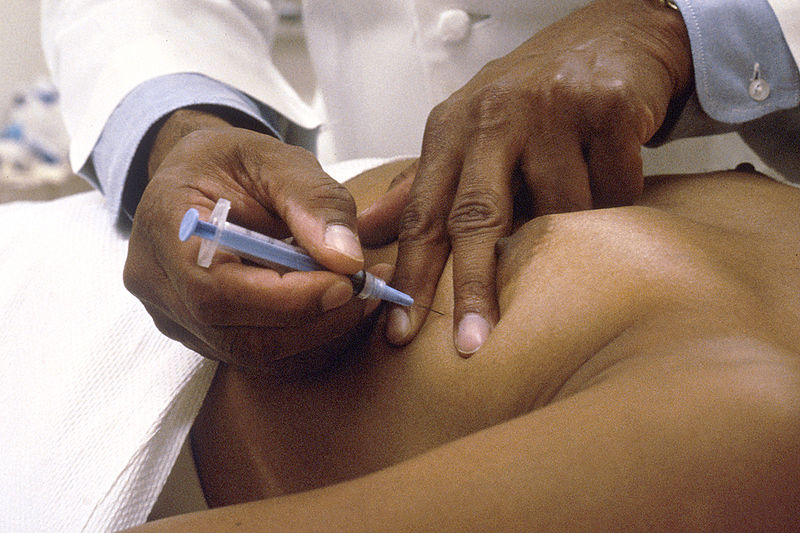 File:Needle biopsy.jpg