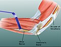 Thumbnail for Osborne's ligament