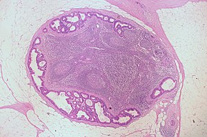 Pathologie: Zum Begriff, Geschichte, Allgemeine und Spezielle Pathologie