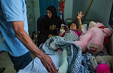 A girl from the Syrian city of Qamishli who lost her leg during the Turkish offensive into north-eastern Syria in October 2019 Baris Pinari harekati sonrasi Kamisli'da yaralandiktan sonra bir ayagi kesilen diger ayagi da kirilan 8 yasindaki Sarah.jpg