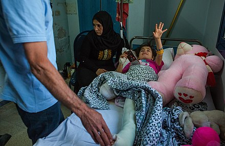 A girl from the Syrian city of Qamishli who lost her leg during the Turkish offensive into north-eastern Syria in October 2019