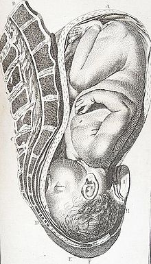 Childbirth - Wikipedia