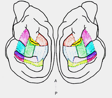 Auditory cortex of a cat brain. The colored sections are those implanted with cryoloops (10 total), which encompass the 13 acoustically responsive sections of the cat auditory cortex. A - anterior, P - posterior. Doublecoloredbrain.PNG