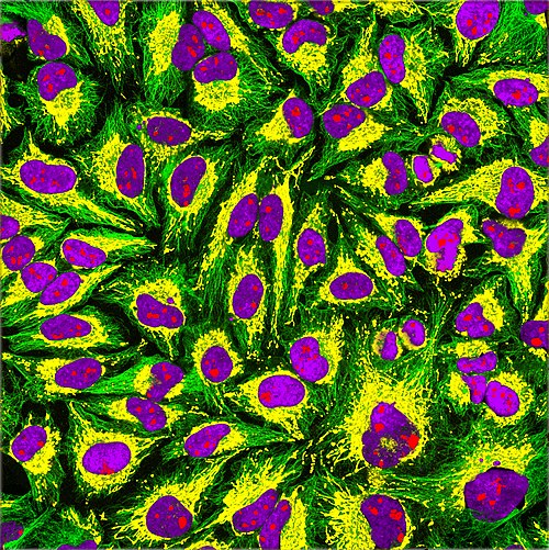 Immunofluorescence of HeLa cells showing microtubules in green, mitochondria in yellow, nucleoli in red and nuclear DNA in purple