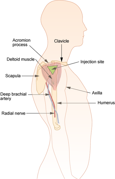 intramuscular injection deltoid