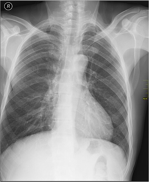 File:Medical X-Ray imaging OUM06 nevit.jpg