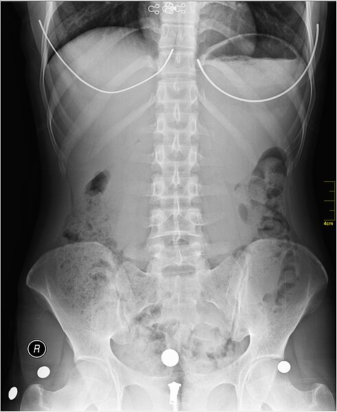 File:Medical X-Ray imaging RZF07 nevit.jpg