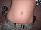 Navel 13 04 1993.jpg