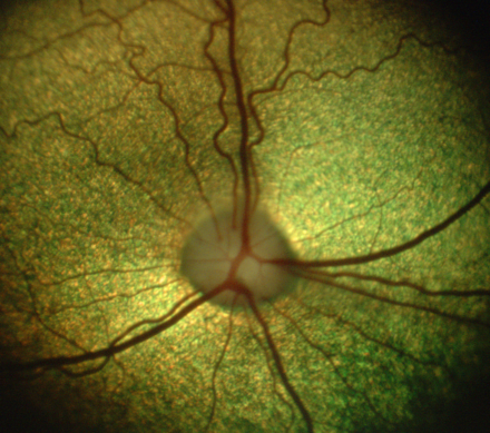 Dog retina showing optic disc and vasculature [epiCam]