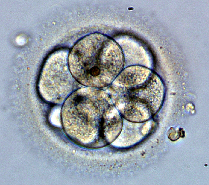 Эмбрион человека на 3 сутки развития, состоит из 8 бластомеров. Автор – NinaSes. Вклад автора (серия фотографий). Посмотреть подробнее изображение и описание к нему.