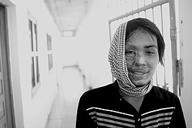 Photo du visage bandé d'une femme victime d'une attaque à l'acide au Cambodge en 2007