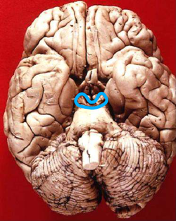 Location of Midbrain in inferior view.png