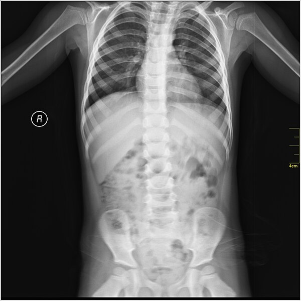 File:Medical X-Ray imaging THR07 nevit.jpg