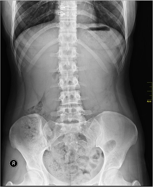 File:Medical X-Ray imaging WZE07 nevit.jpg