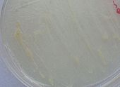 M. abscessus grown in starch-based medium on a Petri dish: Colonies appear as light yellow streaks. Mycobacterium abscessus.jpg